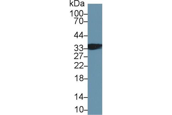 TNNT1 antibody  (AA 1-259)