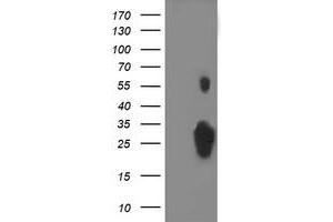 Western Blotting (WB) image for anti-Chromosome 1 Open Reading Frame 50 (C1ORF50) antibody (ABIN1497034) (C1ORF50 Antikörper)