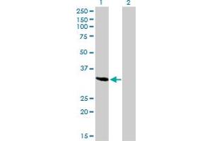 Western Blot analysis of SPARC expression in transfected 293T cell line by SPARC monoclonal antibody (M02A), clone 1B2.