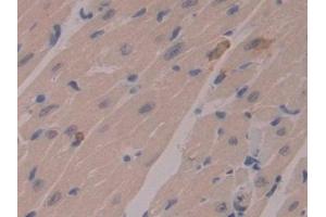 Immunohistochemistry (IHC) image for anti-Matrix Metallopeptidase 7 (Matrilysin, Uterine) (MMP7) (AA 1-264) antibody (ABIN7431017)