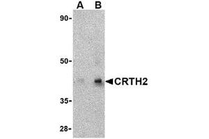 Western blot analysis of CRTH2 in human heart tissue lysate with CRTH2 antibody at (A) 1 and (B) 2 μg/ml. (Prostaglandin D2 Receptor 2 (PTGDR2) (Center) Antikörper)