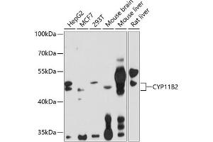Western blot analysis of extracts of various cell lines, using CYP11B2 antibody (ABIN1679468, ABIN3015492, ABIN3015493 and ABIN6218533) at 1:1000 dilution. (CYP11B2 Antikörper  (AA 234-503))