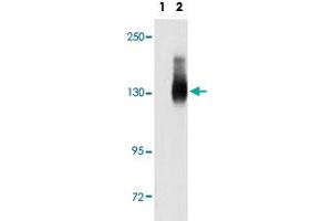 Western blot analysis of JAG2 (arrow) using JAG2 polyclonal antibody . (JAG2 Antikörper  (C-Term))