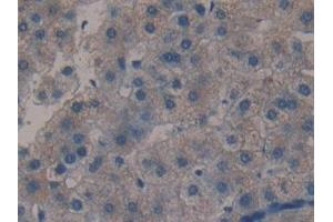 Detection of MBL in Human Liver Tissue using Polyclonal Antibody to Mannose Binding Lectin (MBL) (MBL2 Antikörper  (AA 130-248))