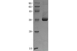 Validation with Western Blot (CA5B Protein)