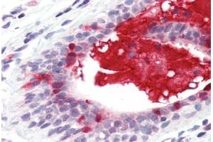 Anti-APRIL antibody IHC staining of human breast. (TNFSF13 Antikörper  (Internal Region))