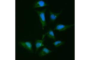 IF analysis of Alpha Actinin 4 using anti-Alpha Actinin 4 antibody (ABIN4886421). (alpha Actinin 4 Antikörper  (AA 561-661))