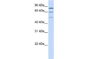 WB Suggested Anti-ZNF699 Antibody Titration:  0. (ZNF699 Antikörper  (N-Term))