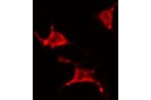ABIN6266801 staining 293 by IF/ICC. (YTHDF1 Antikörper  (N-Term))