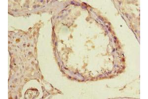 anti-Tetratricopeptide Repeat Domain 30B (TTC30B) (AA 261-600) antibody