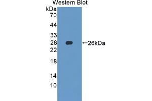 Detection of Recombinant SKP1, Human using Polyclonal Antibody to S-Phase Kinase Associated Protein 1 (SKP1) (SKP1 Antikörper  (AA 1-163))