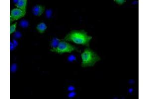 Anti-BDH2 mouse monoclonal antibody (ABIN2452802) immunofluorescent staining of COS7 cells transiently transfected by pCMV6-ENTRY BDH2 (RC210586). (BDH2 Antikörper)