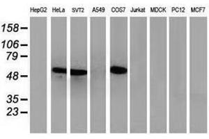 Image no. 5 for anti-Tumor Protein P53 (TP53) antibody (ABIN1499973) (p53 Antikörper)