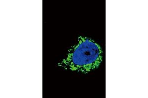 Immunofluorescence (IF) image for anti-Insulin-Like Growth Factor Binding Protein 2, 36kDa (IGFBP2) (AA 277-305), (C-Term) antibody (ABIN652528)