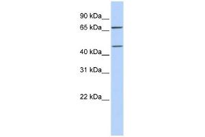 SLC5A7 antibody used at 1 ug/ml to detect target protein. (ChT Antikörper)