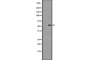 Western blot analysis of GRPR expression in A431 whole cell lysate ,The lane on the left is treated with the antigen-specific peptide. (GRPR Antikörper  (Internal Region))