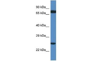 WB Suggested Anti-RPL7A AntibodyTitration: 1.