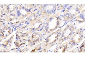 Detection of GCK in Mouse Stomach Tissue using Polyclonal Antibody to Glucokinase (GCK) (GCK Antikörper  (AA 3-226))
