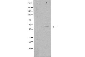 Western blot analysis of Hela whole cell lysates, using ARPC1A Antibody. (ARPC1A Antikörper  (C-Term))