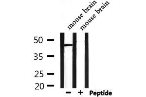 Western blot analysis of extracts from mouse brain, using NPY1R Antibody. (NPY1R Antikörper  (Internal Region))