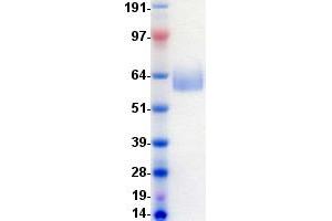 Western Blotting (WB) image for AXL Receptor tyrosine Kinase (AXL) protein (DYKDDDDK-His Tag) (ABIN2715090)