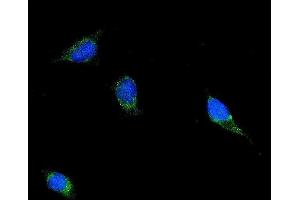 IF analysis of Filamin B/FLNB using anti-Filamin B/FLNB antibody (ABIN7601606).