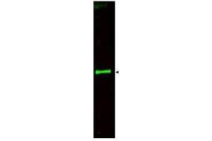 Image no. 1 for anti-Slit Homolog 3 (SLIT3) (AA 1164-1177) antibody (ABIN199965) (SLIT3 Antikörper  (AA 1164-1177))