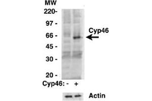 Western analysis of CYP46A1 in HEK293 cells overexpressing CYP46A1 or transfected with an empty vector using CYP46A1 polyclonal antibody . (CYP46A1 Antikörper)