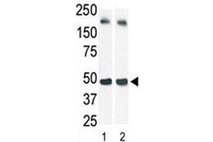 The SphK1 antibody used in western blot (lane 2) to detect c-myc-tagged SphK1 in transfected 293 cell lysate (a c-myc antibody is used as control in Lane 1).