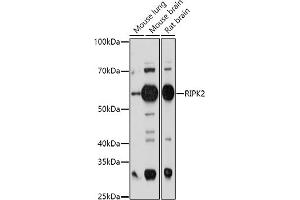 Western blot analysis of extracts of various cell lines, using RIPK2 antibody (ABIN3023312, ABIN3023313, ABIN3023314 and ABIN6219574) at 1:1000 dilution. (RIPK2 Antikörper  (AA 1-540))