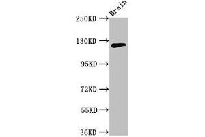 Western Blot Positive WB detected in: Mouse brain tissue All lanes: MYRF antibody at 3. (Chromosome 11open Reading Frame 9 (C11orf9) (AA 843-1004) Antikörper)