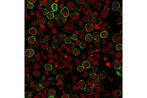 Immunofluorescence (IF) image for anti-Membrane-Spanning 4-Domains, Subfamily A, Member 1 (MS4A1) antibody (ABIN6941107)
