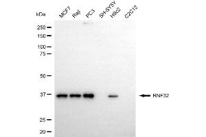 anti-Ring Finger Protein 32 (RNF32) antibody