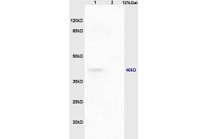Lane 1: mouse embryo lysates Lane 2: mouse spleen lysates probed with Anti CCR9 Polyclonal Antibody, Unconjugated at 1:200 in 4 ˚C. (CCR9 Antikörper  (AA 65-160))