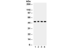 Western blot testing of 1) rat lung, 2) rat kidney, 3) human COLO320 and 4) MCF7 lysate with CTBP1 antibody. (CTBP1 Antikörper)