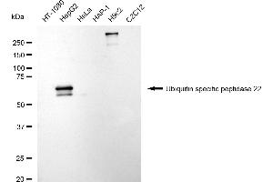 Western blotting analysis using ubiquitin specific peptidase 22 antibody (ABIN7800730).