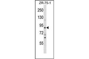 Western blot analysis of SLITRK4 Antibody (C-term) in ZR-75-1 cell line lysates (35ug/lane). (SLITRK4 Antikörper  (C-Term))