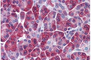 Human Pancreas: Formalin-Fixed, Paraffin-Embedded (FFPE) (SQSTM1 Antikörper  (AA 323-372))