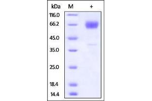 SDS-PAGE (SDS) image for Hepatitis A Virus Cellular Receptor 2 (TIM 3) (AA 20-191) protein (Fc Tag) (ABIN2870767)