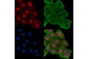 anti-Breast Cancer 2, Early Onset (BRCA2) (pSer3291) antibody