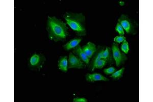 Immunofluorescence staining of A549 cells with ABIN7144485 at 1:166, counter-stained with DAPI. (APAF1 Antikörper  (AA 104-415))