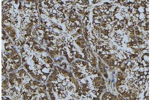 ABIN6268857 at 1/100 staining Mouse testis tissue by IHC-P. (CRHR1 Antikörper  (Internal Region))