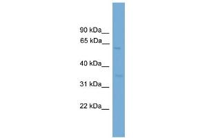 WB Suggested Anti-MFSD8 Antibody Titration: 0. (MFSD8 Antikörper  (Middle Region))