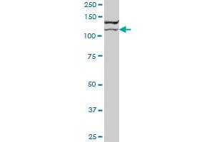 BCOR MaxPab polyclonal antibody. (BCOR Antikörper  (AA 1-1004))