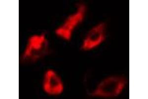 ABIN6274638 staining 293 cells by IF/ICC. (CYP21A2 Antikörper  (Internal Region))