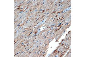 Immunohistochemistry of paraffin-embedded rat heart using Creatine kinase B type (CKB) Rabbit mAb (ABIN7266515) at dilution of 1:100 (40x lens). (CKB Antikörper)