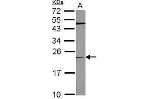 WB Image Sample (50 ug of whole cell lysate) A: mouse brain 12% SDS PAGE antibody diluted at 1:500 (TPT1 Antikörper)