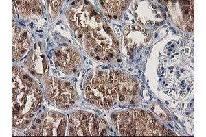 Immunohistochemical staining of paraffin-embedded Human Kidney tissue using anti-SULT1C2 mouse monoclonal antibody. (SULT1C2 Antikörper)