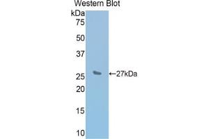 Western blot analysis of the recombinant protein. (IL2 Receptor beta Antikörper  (AA 27-240))