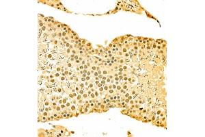 Immunohistochemistry of paraffin embedded rat testis using HOXC9 (ABIN7074251) at dilution of 1:700 (300x lens) (HOXC9 Antikörper)